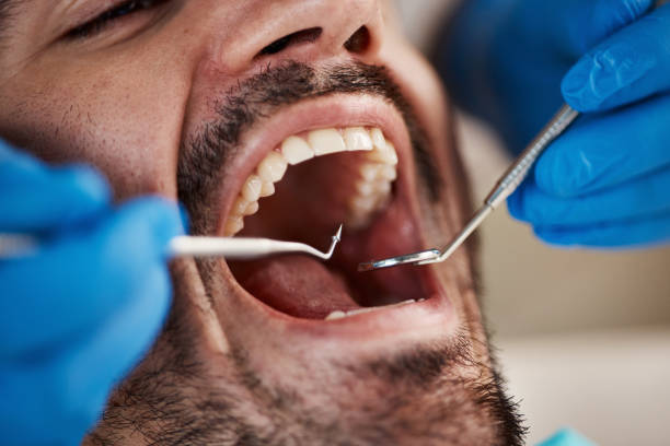 Best Mobile Emergency Dentist in Rockfish, NC