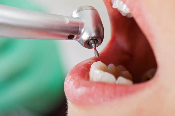 Best Weekend Emergency Dentist in Rockfish, NC